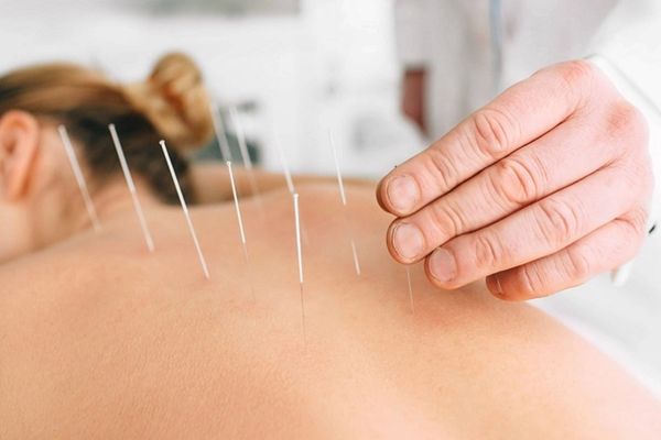 Acupuntura em Picos Piauí